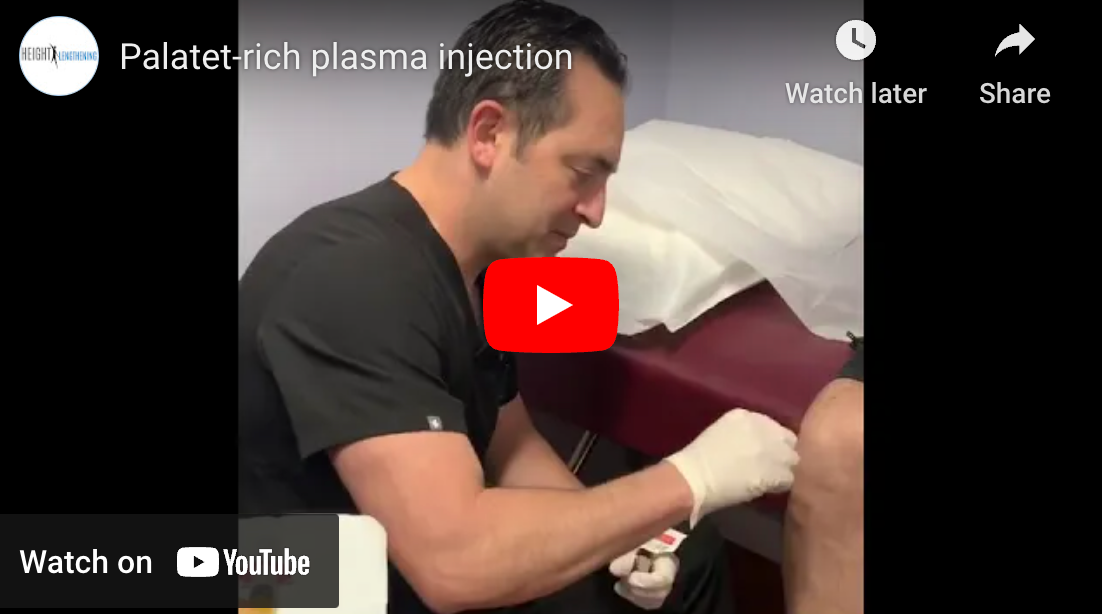 Palatet rich plasma injection